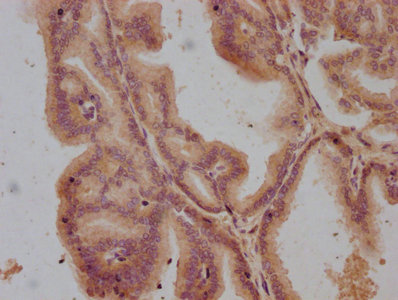 CSB-PA009820OA01HU