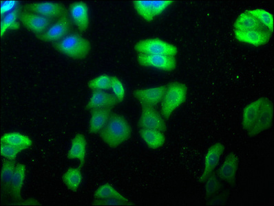 CSB-PA010823HA01HU