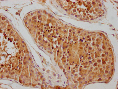 CSB-PA010823HA01HU