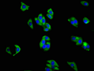 CSB-PA011861LA01HU