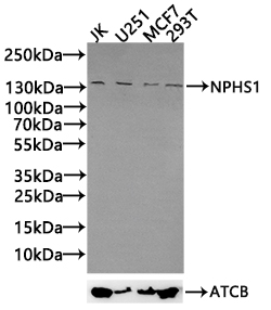 CSB-PA015988LA01HU