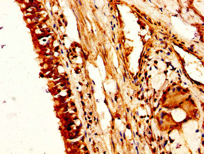 CSB-PA016146HA01HU