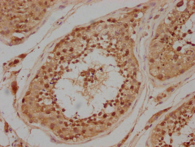 CSB-PA018688LA01HU