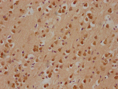 CSB-PA018688LA01HU