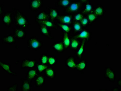 CSB-PA021788ESR2HU