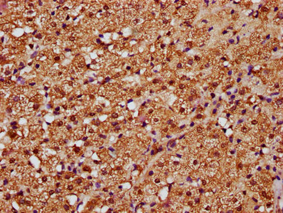 CSB-PA021788ESR2HU