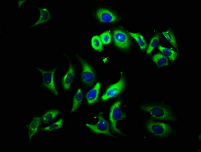 CSB-PA025399LA01HU