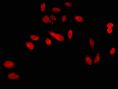 CSB-PA619760LA01HU