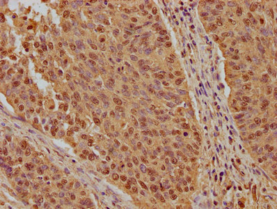 CSB-PA622929LA01HU