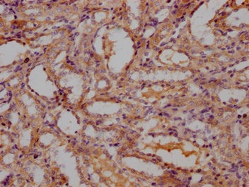 CSB-PA714125OA01RA IHC