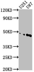 CSB-PA719399LA01HU