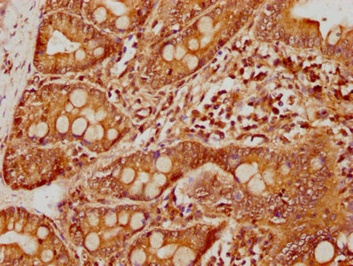 CSB-PA801222LA01HU