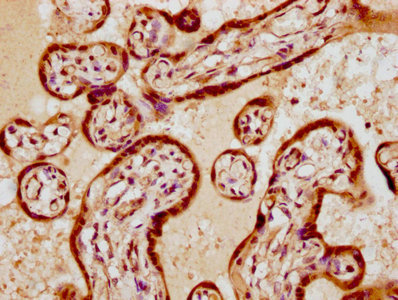 CSB-PA858733LA01HU