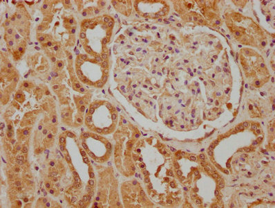 CSB-PA878932OA01HU