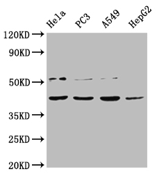 CSB-PA890667LA01HU