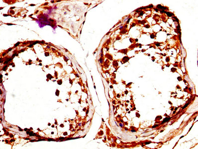 CSB-PA891553LA01HU