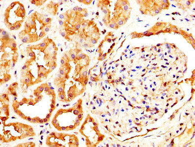 CSB-PA891553LA01HU