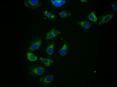 CSB-PA891555LA01HU