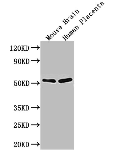 CSB-PA001391LA01HU