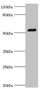 CSB-PA001463ESR2HU
