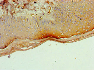 CSB-PA004889ESR2HU