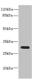 CSB-PA004895ESR2HU