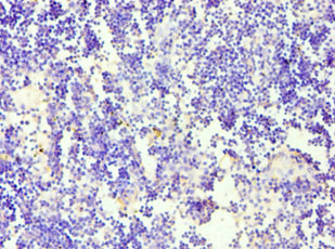 CSB-PA004964ESR1HU