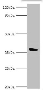 CSB-PA004964ESR1HU
