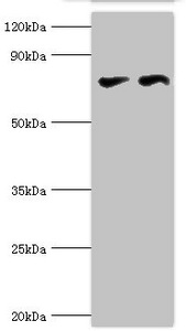 CSB-PA006138DSR2HU