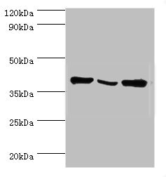 CSB-PA007537ESR1HU