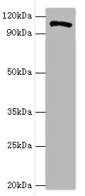CSB-PA010365ESR2HU