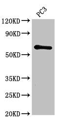 CSB-PA010737LA01HU