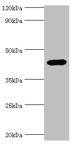 CSB-PA011622ESR1HU