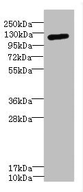 CSB-PA011879ESR1HU