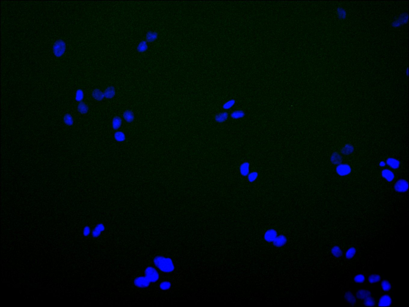 CSB-PA012091LA01HU