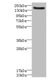 CSB-PA013251ESR1HU