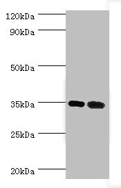CSB-PA013332ESR2HU