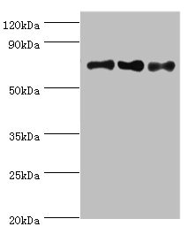 CSB-PA015535DSR2HU
