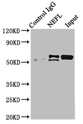 CSB-PA015688LA01HU