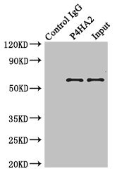 CSB-PA017340ESR2HU