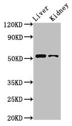 CSB-PA018973LA01HU