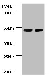 CSB-PA021788ESR2HU