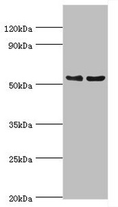 CSB-PA023429ESR1HU