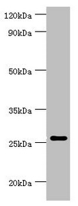 CSB-PA023989ESR1HU