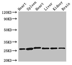 CSB-PA025834LA01HU