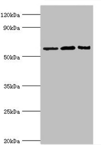 CSB-PA621688ESR2HU