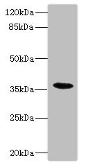 CSB-PA734093ESR2HU