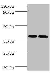 CSB-PA822241DSR1HU