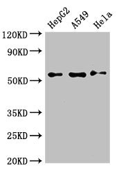CSB-PA835690LA01HU