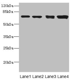 CSB-PA839321ESR2HU